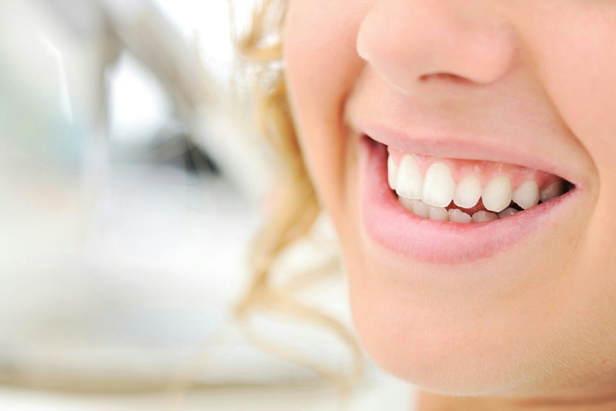 Come la pulizia dei denti trasforma il sorriso più della tua routine quotidiana di bellezza