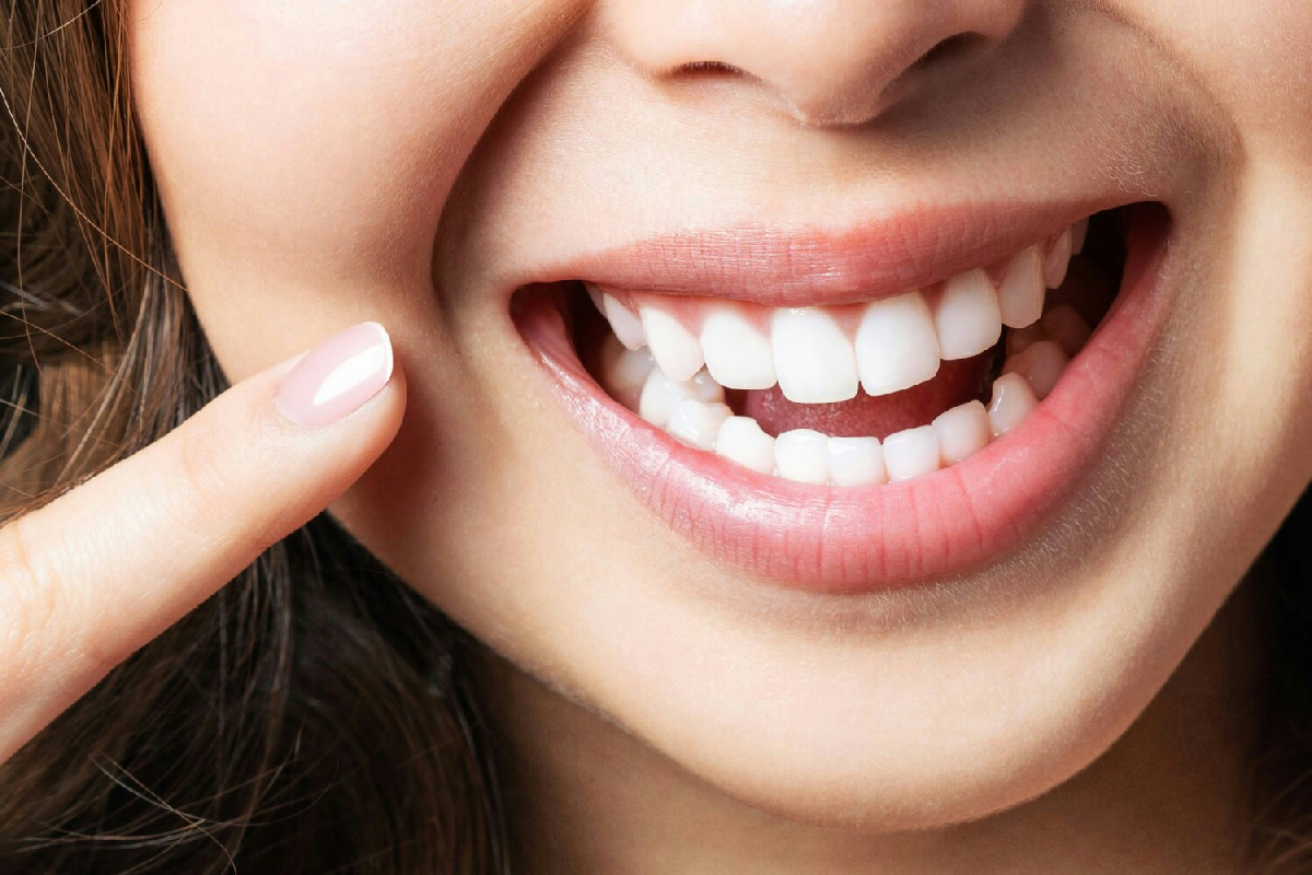 Come la pulizia dei denti trasforma il sorriso più della tua routine quotidiana di bellezza